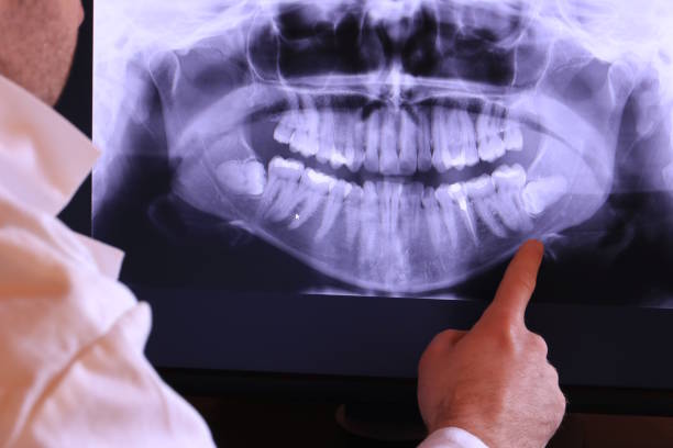Best Emergency Dentist for Lost Fillings or Crowns in Godfrey, IL